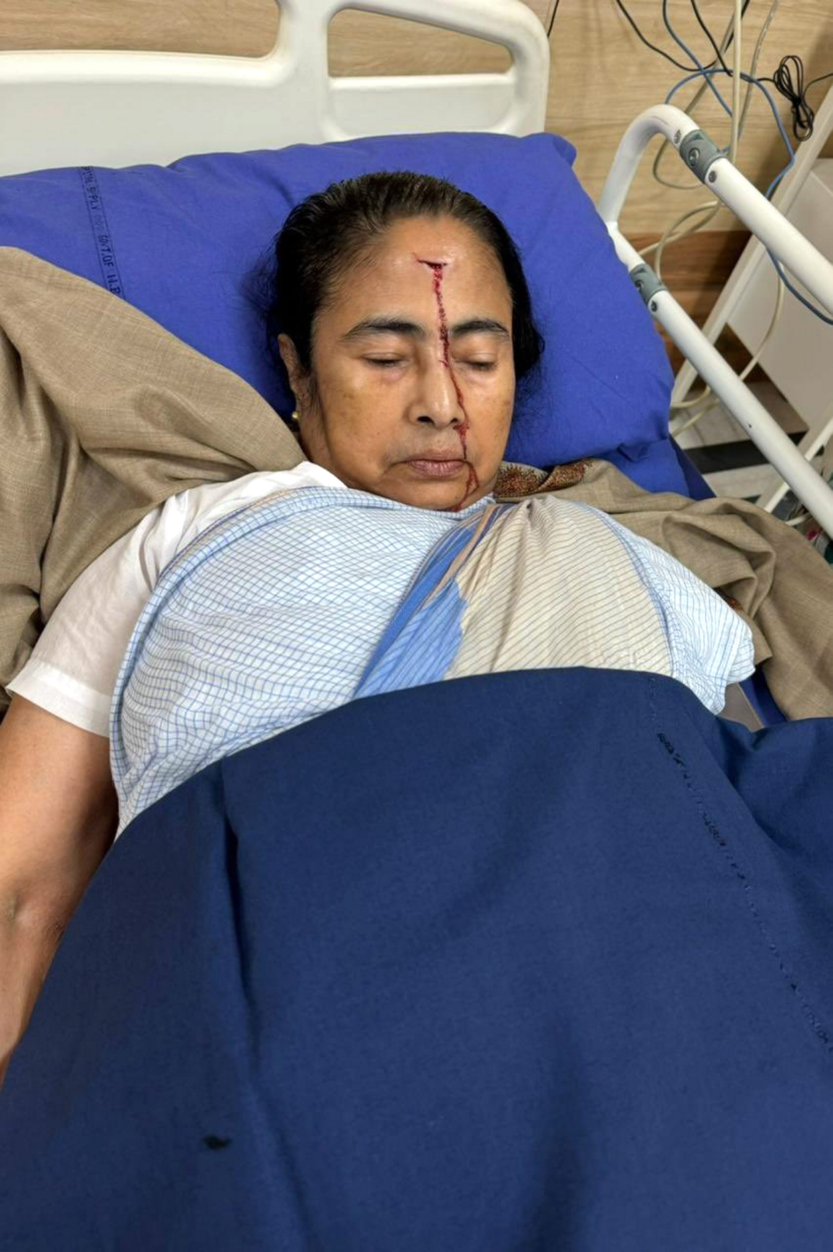 V-P Dhankhar enquires about Mamata Banerjees health after accident, wishes  speedy recovery